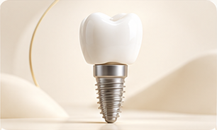 İmplant tedavisini temsil eden diş implantı